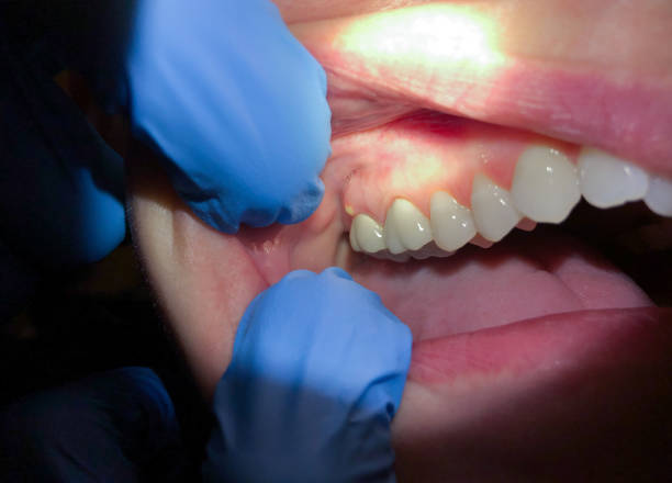 Best Broken or Cracked Tooth Emergency Dentist in Roscoe, TX
