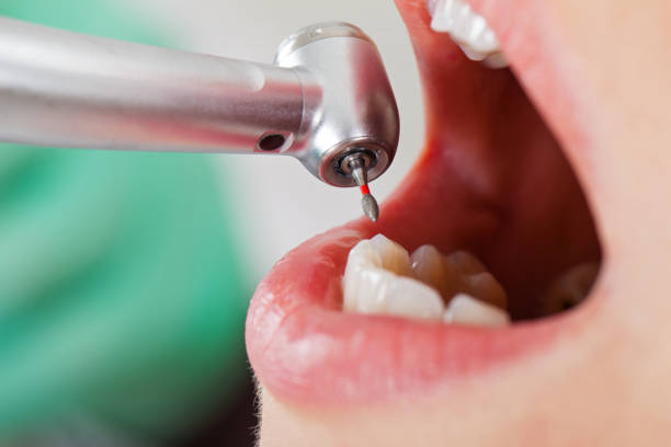 Best Orthodontic Emergency Dentist in Roscoe, TX